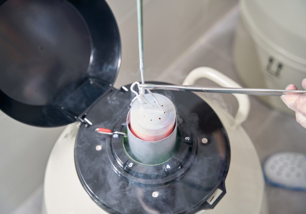 Health worker puts biomaterial into a tank with liquid nitrogen, this is a modern method of embryo vitrification